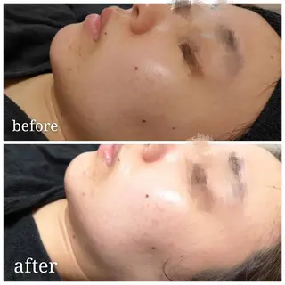 🅖🅤🅩🅔🅛 salonのエステ・リラクイメージ