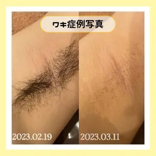 金山/脱毛/美肌 ULULUのエステ・リラクイメージ