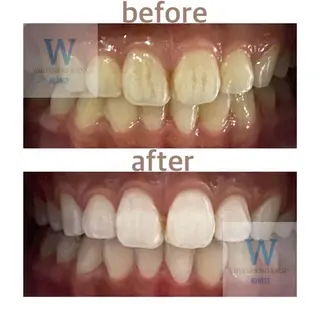 ホワイトニング ショップ船橋店🦷のエステ・リラクイメージ