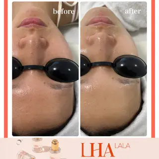 Liam《美肌管理/ 3D小顔/脂肪ケア》のエステ・リラクイメージ