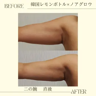 痩身小顔専門 アマテ ビューティー.Nのエステ・リラクイメージ