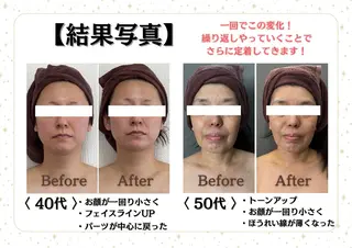 Eminy by  L★sのエステ・リラクイメージ