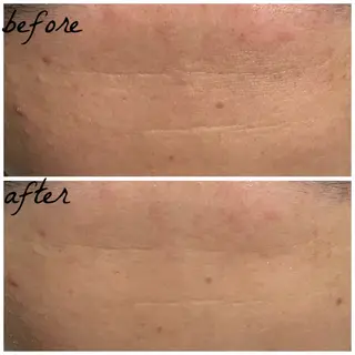 メンズ メナード岐阜市茜部 杉浦のエステ・リラクイメージ