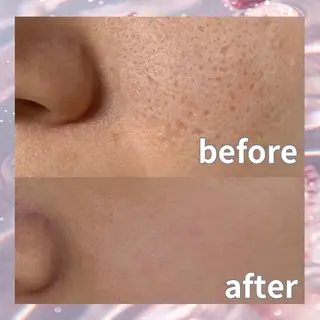 愛維美水光美肌専門店所属・愛維美水光美肌専門店 メンズレディースokのエステ・リラクイメージ