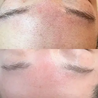 abbellina×UNO出雲塩冶店《ウノ》所属・フェイシャルエステ 🫧琉衣のエステ・リラクイメージ