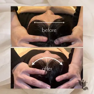 【vidyto】ヴィディトゥ所属・肌管理サロン vidyto　MOEのエステ・リラクイメージ