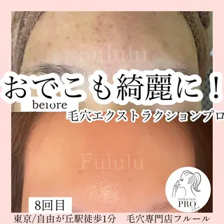 毛穴専門サロン　フルール所属・フルールFululu 自由が丘のエステ・リラクイメージ
