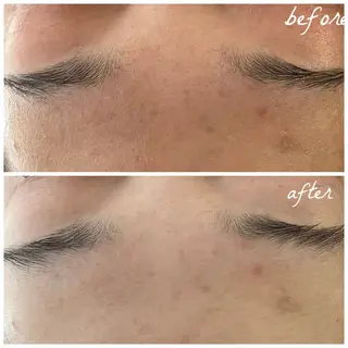 メンズ メナード岐阜茜部 杉浦のエステ・リラクイメージ