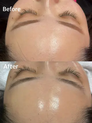 小顔専門看護師クリニカルサロンCOCO所属・小顔と美肌サロン クリニカルサロンココのエステ・リラクイメージ