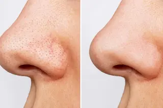 アイアンド ネイルデイのエステ・リラクイメージ