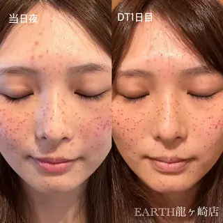 earth龍ヶ崎/ 脱毛/シミ取り🆕のエステ・リラクイメージ