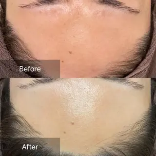 産毛専門店 Bittoのエステ・リラクイメージ