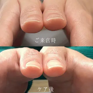 ネイル Aim* 深爪・自爪育成専門店のネイルデザイン