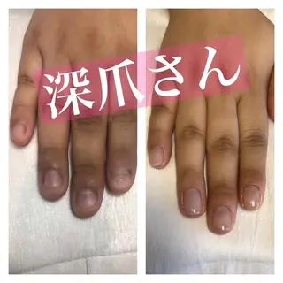 ネイル 山崎 みゆきのネイルデザイン