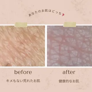 メンズ 韓国最先端技術サロン Luangeのエステ・リラクイメージ