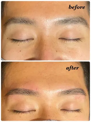 アイブロウ ハーブピーリング/韓国肌管理/フェイシャル/毛穴洗浄/眉毛/顔脱毛【糸脱毛専門】rev所属・ハーブピーリング🌹 毛穴洗浄❤️眉waxのエステ・リラクイメージ