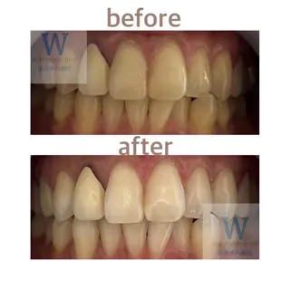 ホワイトニング ショップ本八幡店のエステ・リラクイメージ