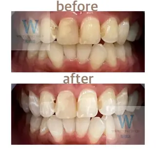 ホワイトニング ショップ船橋店🦷のエステ・リラクイメージ