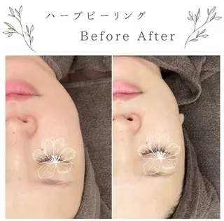 な ぎのエステ・リラクイメージ