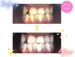 メンズ エクシアホワイトニング草津店所属・nanami -ホワイトニングのその他イメージ