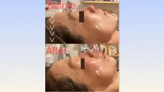 CHERIE所属・CHERIE Akaneのエステ・リラクイメージ