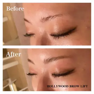 アイブロウ Ｂ&H所属・頭痛•肩こり専門/ 眉サロンB&H心斎橋のエステ・リラクイメージ