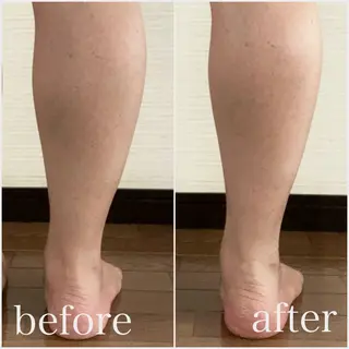 PIUMA 筋膜リリース・リンパのエステ・リラクイメージ