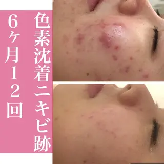 ミディアム カラー パーマ ヘアアレンジ メンズ キッズ ネイル マツエク・マツパ ニキビ・肌質改善専門 ♡人生が変わるサロンのエステ・リラクイメージ