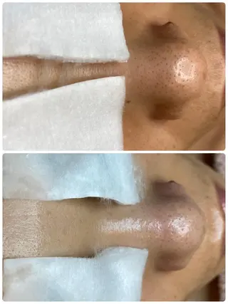 +M所属・竹ノ内 理恵のエステ・リラクイメージ