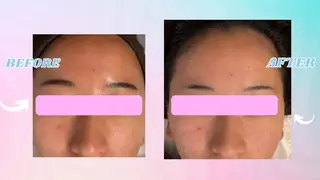 POWER OF BEAUTY所属・🎀TOMO🎀 “””のエステ・リラクイメージ