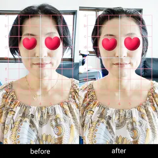 セルフエステとよもぎ 蒸しDispelfのその他イメージ