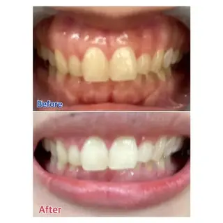 M渋谷店所属・Ｍ渋谷 ホワイトニングのエステ・リラクイメージ