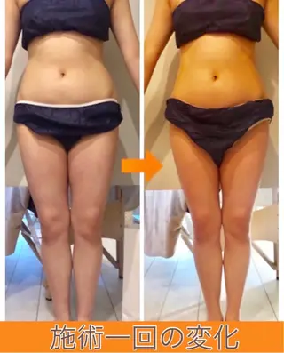 ロング カラー パーマ ヘアアレンジ メンズ キッズ ネイル マツエク・マツパ ‍痩身＆ボディ 結果出し🌟丹野のエステ・リラクイメージ