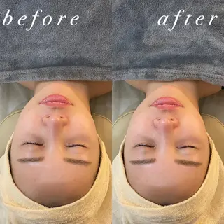 うなじ脱毛/美肌脱毛 LABELのエステ・リラクイメージ