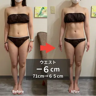 骨盤矯正ダイエット ぷりんす整体COZYのエステ・リラクイメージ