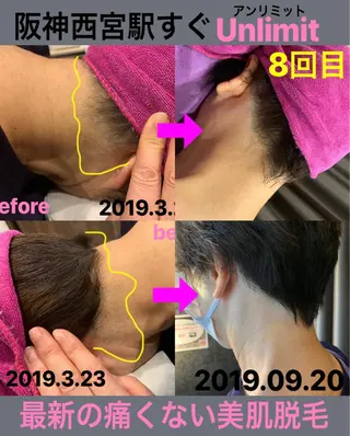 脱毛＆エステサロン【アンリミット】所属・森谷 莉美のエステ・リラクイメージ