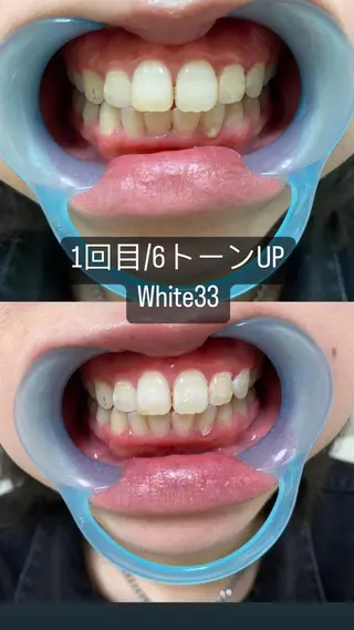 アイブロウ セルフホワイトニング White33大名のその他イメージ