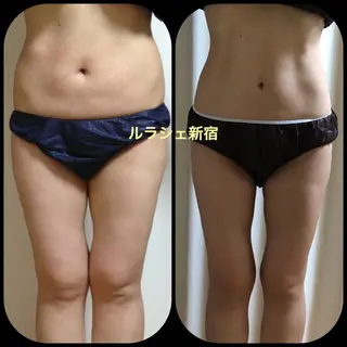 【痩身】インドエステ ＆筋膜リリースのエステ・リラクイメージ