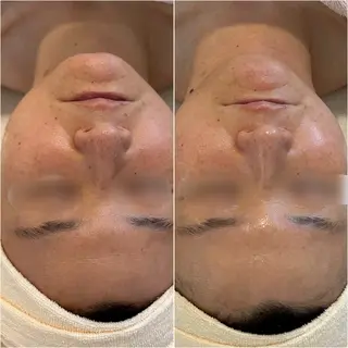 〈etre〉トータルビューティーサロン所属・etre - 韓国肌管理 -のエステ・リラクイメージ