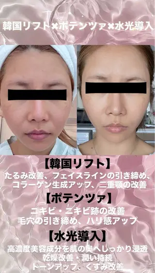 パーマ aliaハイフ&水光ジェットサロン所属・aliaハーブ水光店 エステティシャン募集のエステ・リラクイメージ