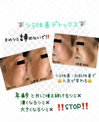 ヴィーナス ビューティーのエステ・リラクイメージ