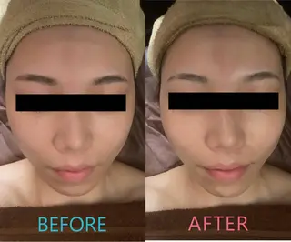 ハウオリベリー所属・うえば すみかのエステ・リラクイメージ