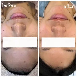 facial aesthetic salon SENTEUR所属・美肌改善/毛穴/シミ サントゥールのエステ・リラクイメージ