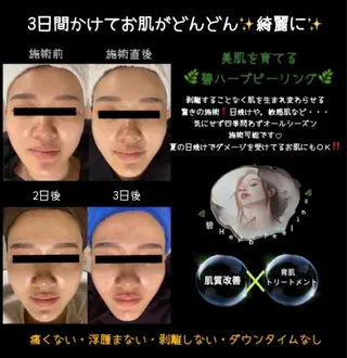 ヴィーナス ビューティーのエステ・リラクイメージ