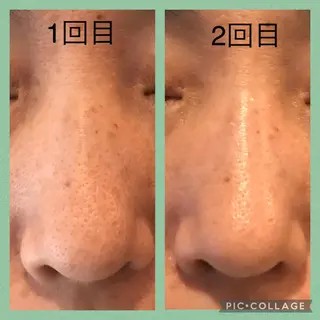 隠れ家フェイシャル&ドライヘッドケア新座所属・隠れ家フェイシャル＆ ドライヘッドケア新座のエステ・リラクイメージ