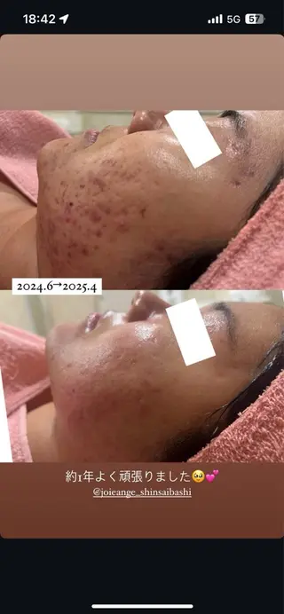 フェイシャル/脱毛 ジョアアンジェ竹田のエステ・リラクイメージ