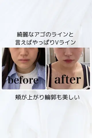 小顔と ヘッドスパのお店のエステ・リラクイメージ