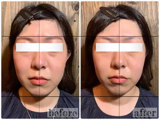 💎後悔させない小顔 矯正💎イトヤマ🌱のエステ・リラクイメージ