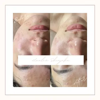 美腸サロン【腸もみ &アロマリンパ】のエステ・リラクイメージ