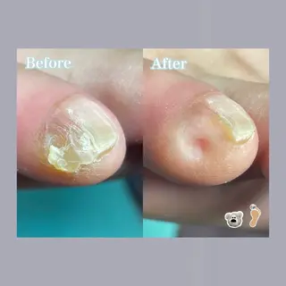 巻き爪補正店 大阪天王寺店のネイルデザイン